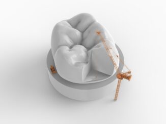 Реставрация зубов - показания и методы